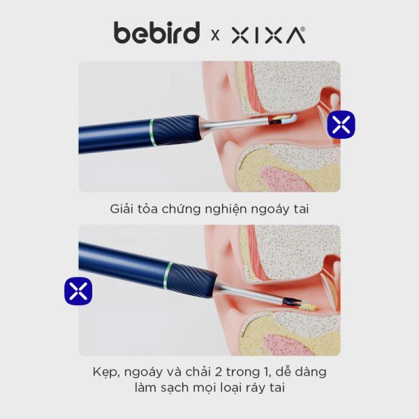 Bộ dụng cụ lấy ráy tai thông minh Xixa Bebird Note 5 Pro 7